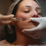 clínica para preenchimento facial bigode chinês Jabaquara