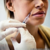 preenchimento facial bigode chinês Brooklin