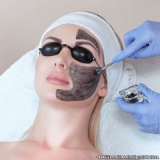 agendamento de peeling para acne Campo Limpo