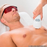depilacao-a-laser-depilacao-a-laser-axila-clinica-que-faz-depilacao-a-laser-na-axila-jabaquara