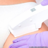 depilacao-a-laser-depilacao-a-laser-axila-clinica-que-faz-depilacao-a-laser-virilha-completa-ibirapuera