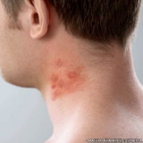 dermatologista-dermatologista-de-alergias-dermatologista-de-pele-jardim-paulistano
