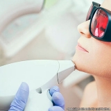 depilacao-a-laser-depilacao-a-laser-axila-clinica-que-faz-depilacao-a-laser-pele-negra-sao-joao-climaco