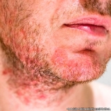 dermatologista-dermatologista-de-alergias-dermatologista-de-pele-preco-campo-grande