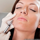 preenchimento-facial-botox-e-preenchimento-facial-clinica-para-botox-e-preenchimento-facial-morumbi