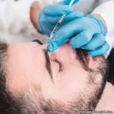 preenchimento-facial