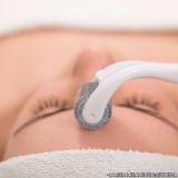 microagulhamento-microagulhamento-acne-clinica-de-microagulhamento-acne-vila-agua-funda