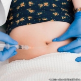 microagulhamento-microagulhamento-acne-clinica-de-microagulhamento-acne-jabaquara