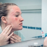 dermatologista-dermatologista-de-alergias-dermatologista-de-alergias-preco-saude