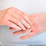 dermatologista-dermatologista-de-alergias-consulta-com-dermatologista-e-alergista-jardim-europa