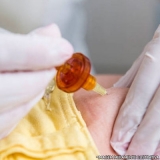 microagulhamento-microagulhamento-acne-clinica-de-microagulhamento-para-acne-brooklin