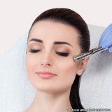 peeling-peeling-acne-agendamento-de-peeling-para-estrias-jardim-imperador